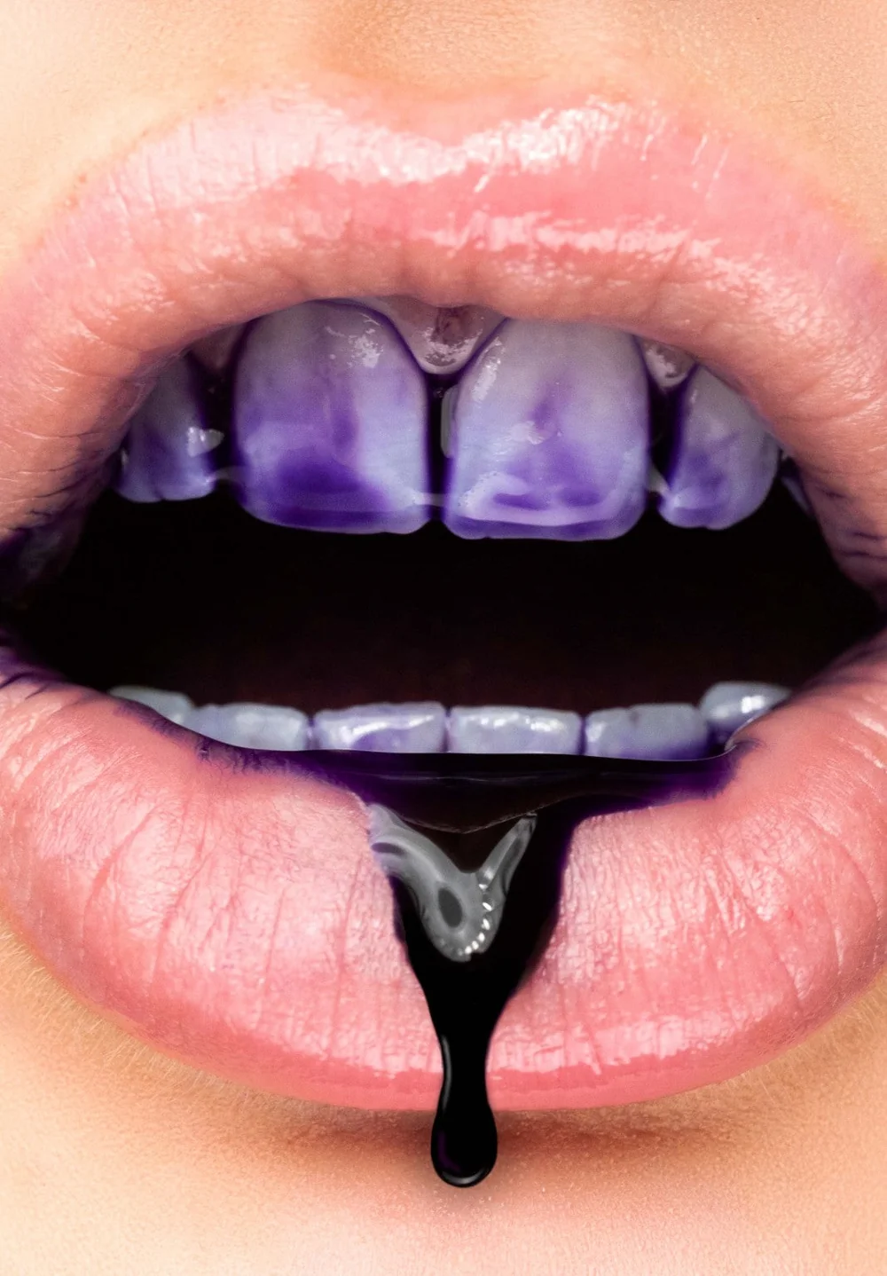 Sérum violeta aplicado sobre los dientes